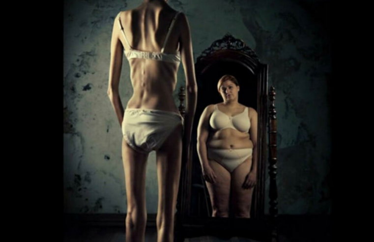 Anorexia, transtorno alimentar que pode levar à morte se não optar por tratamento